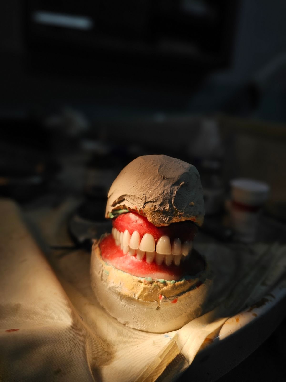 Dentures