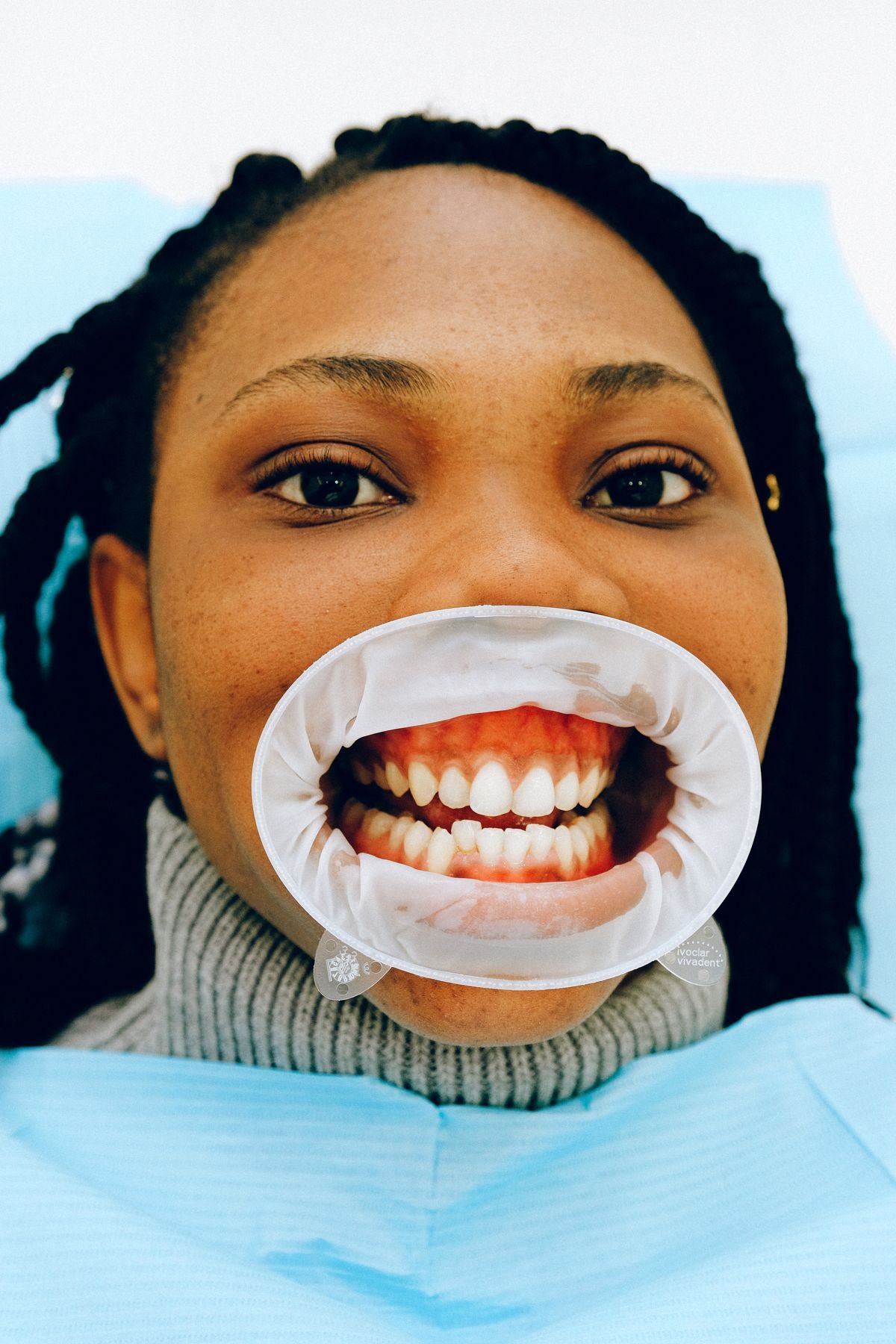 Removable Braces